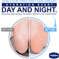 Vaseline Foot Cream Deep Moisture 55g